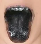 Unbenannt.webp